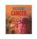 What You Need to Know About Cancer Book